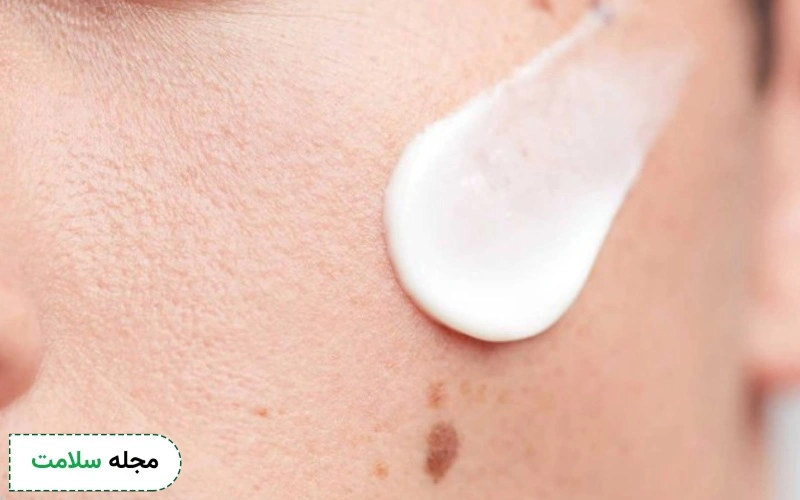 موارد احتیاط مصرف کرم زینک اکساید چیست؟