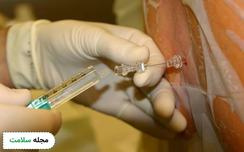 انواع بیهوشی نخاعی چیست؟