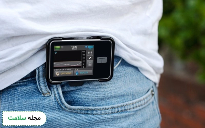 پمپ انسولین چیست؟ آیا همه افراد دیابتی می توانند از آن استفاده کنند؟