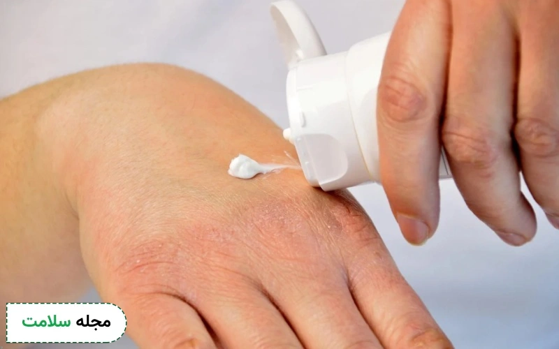 منع مصرف کرم زینک اکساید چیست؟