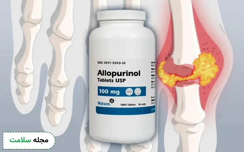 موارد احتیاط و منع مصرف آلوپورینول