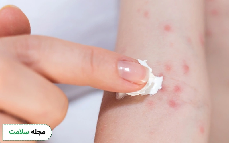 موارد ممنوعیت مصرف تریامسینولون چیست؟