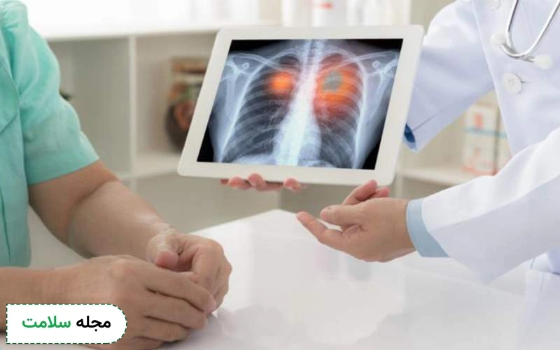 انواع آزمایش سرطان ریه چیست؟