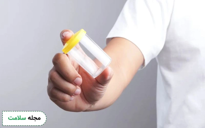 عکس جواب آزمایش اسپرم نرمال چگونه است؟