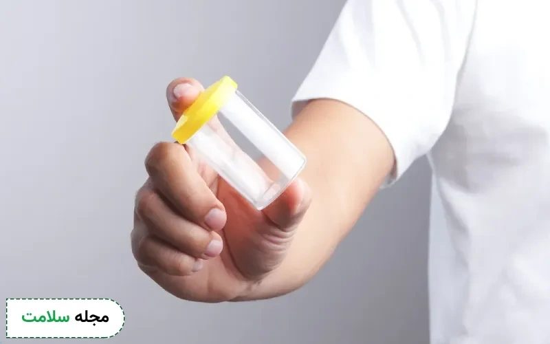 liquefaction time در آزمایش اسپرم چه معنایی دارد؟