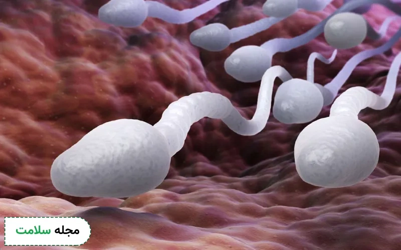 فاکتورهای موجود در نتیجه آزمایش اسپرم چیست؟