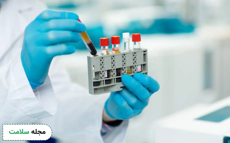 آزمایش cpk چه زمانی انجام میشود؟