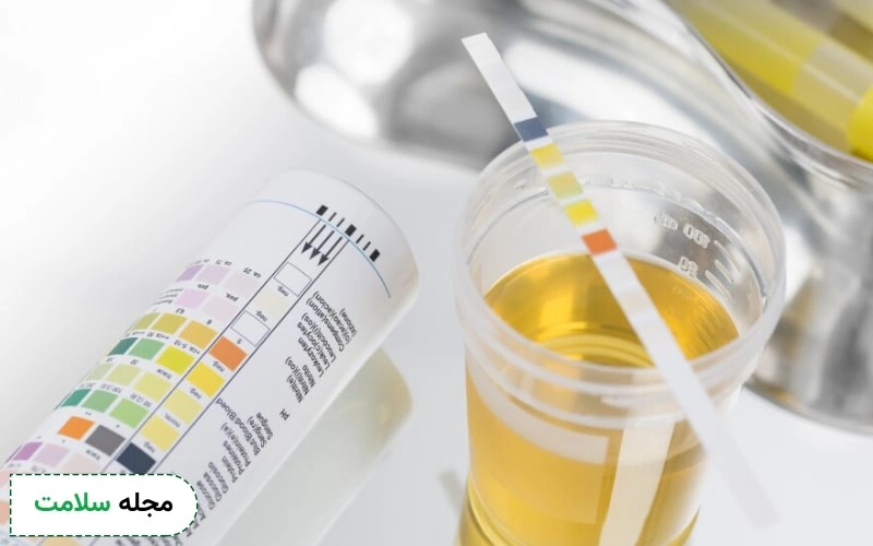 میزان نرمال bacteria در آزمایش ادرار چقدر است؟