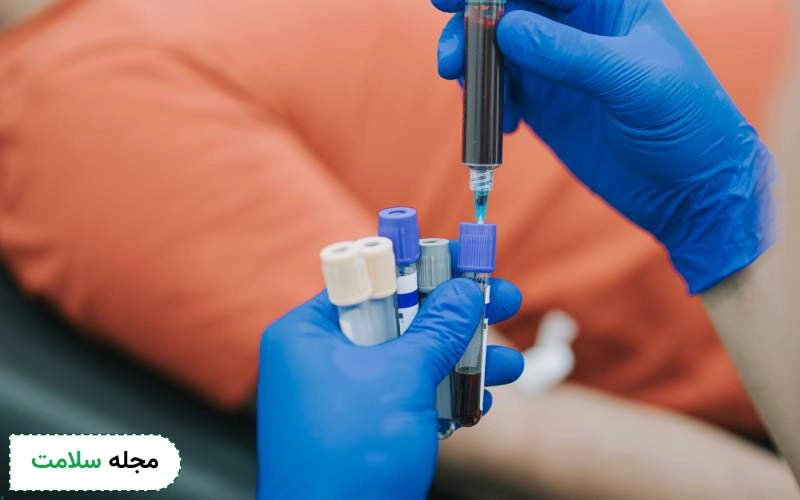 آزمایش پتاسیم خون چیست؟