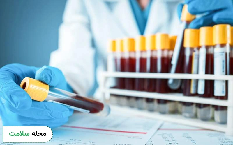 آزمایش cpk چیست؟