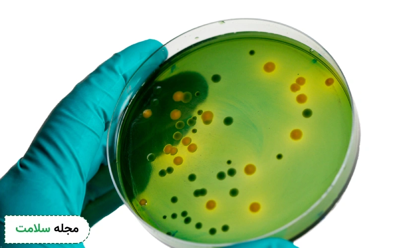 Bacteria در آزمایش ادرار نشان دهنده چیست؟