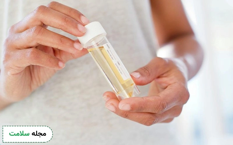 تست بارداری خانگی بانمک چقدر طول میکشد؟