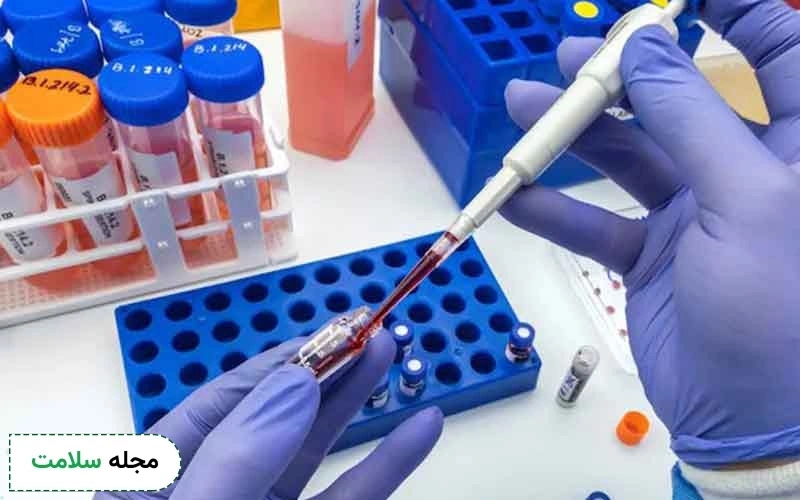 علائم تومور مغزی در ازمایش خون (ازمایش تومور مغزی)