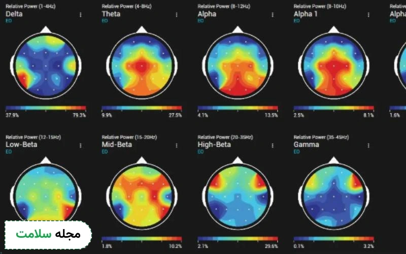 بخش سیگنال خام EEG و نمودار امواج مغزی چگونه تفسیر می شود؟