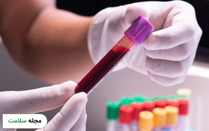 آزمایش پتاسیم خون به چه دلیل انجام می شود؟