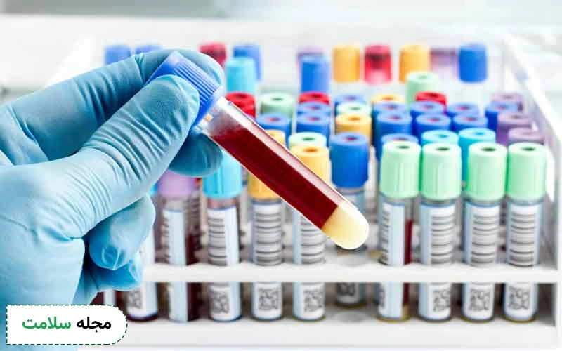 علائم اولیه تومور مغزی در ازمایش خون چیست؟