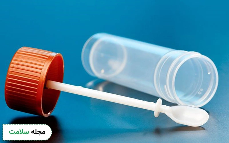 آیا تشخیص سرطان روده با آزمایش مدفوع امکانپذیر است؟