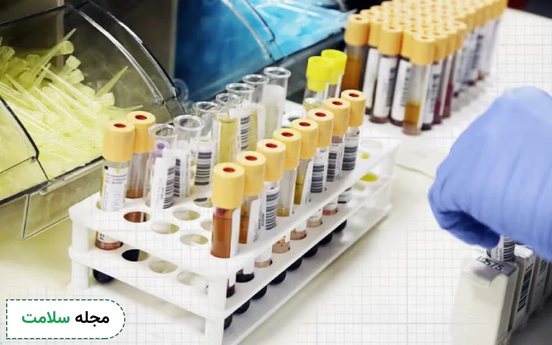 آیا نتیجه مثبت wbc در آزمایش ادرار نشان دهنده عفونت‌ باکتریایی است؟
