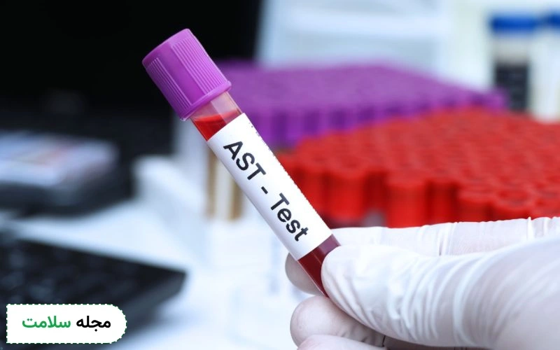 ast در آزمایش خون چیست؟