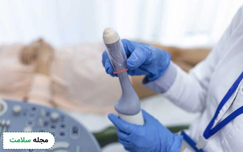 سونوگرافی واژینال و تمام آنچه باید درباره آن بدانید