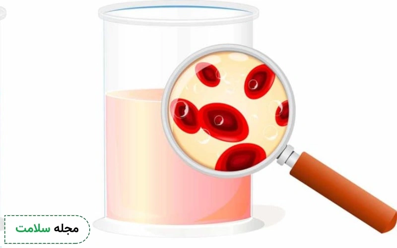 تفسیر Blood مثبت در آزمایش ادرار چیست؟