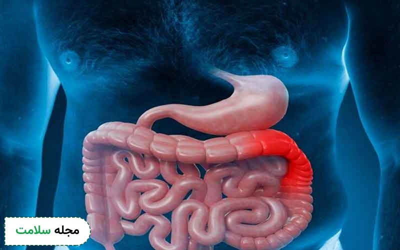 آیا امکان تشخیص سرطان معده در چند دقیقه وجود دارد؟