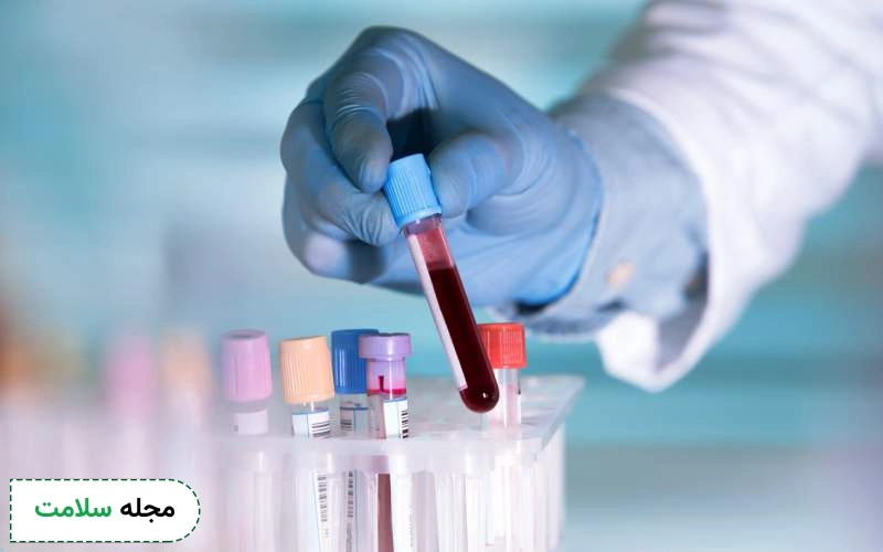 رعایت نکات مهم قبل و بعد آزمایش یائسگی ضروری است.