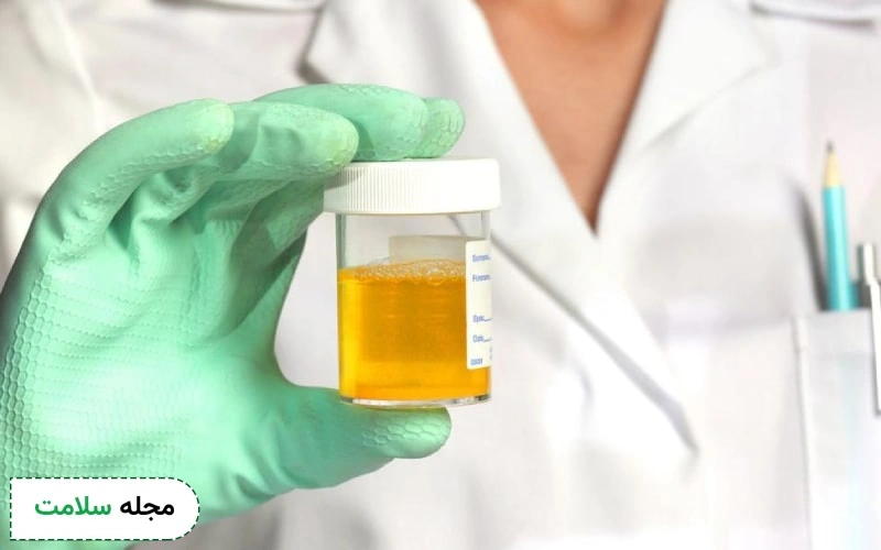 میزان نرمال WBC در آزمایش ادرار چقدر است؟