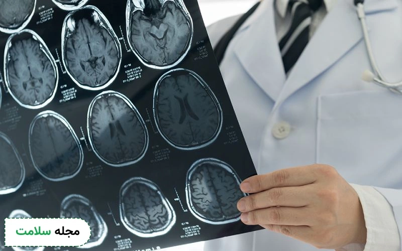 فرق نوار مغز و سی تی اسکن مغز چیست؟