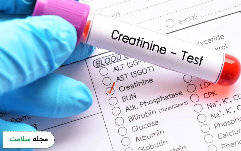 بررسی میزان نرمال کراتین خون در بزرگسالان