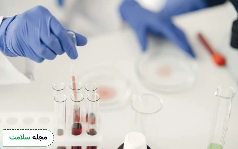 آزمایش ژنتیکی هموکروماتوز چگونه تفسیر می شود؟