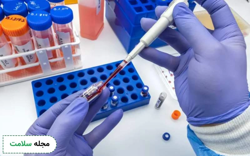 علائم سرطان روده در آزمایش خون چیست؟