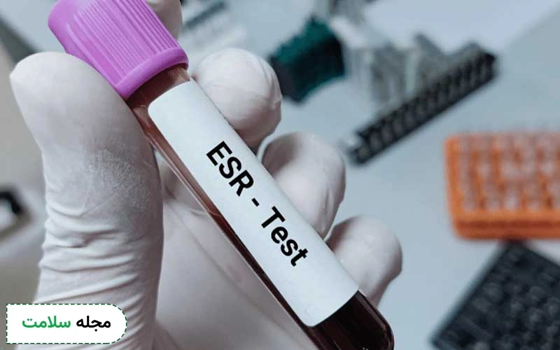 ESR در آزمایش خون چیست؟