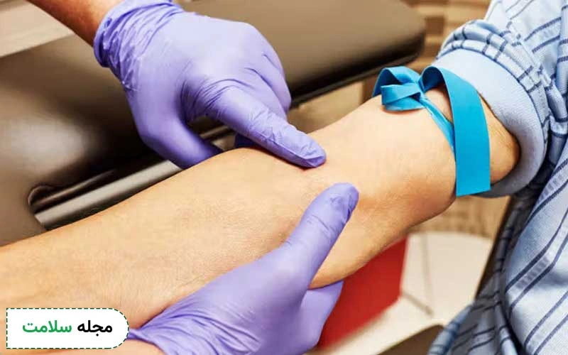 آمادگی قبل آزمایش lym چیست؟ 