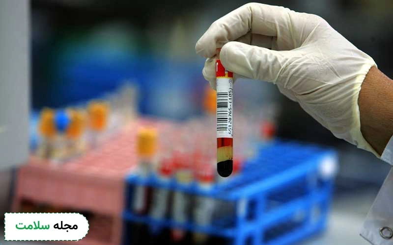 محدوده خطرناک در RDW آزمایش خون چقدر است؟