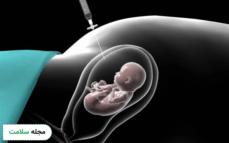 جواب آمنیوسنتز چند روزه اماده میشه؟