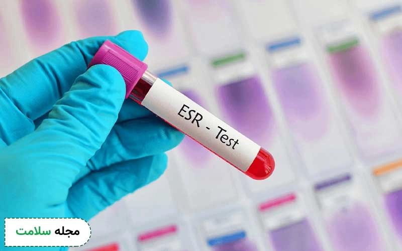 بالا بودن ESR در آزمایش خون نشانه چیست؟ مقدار ESR در سرطان خون و محدوده خطر