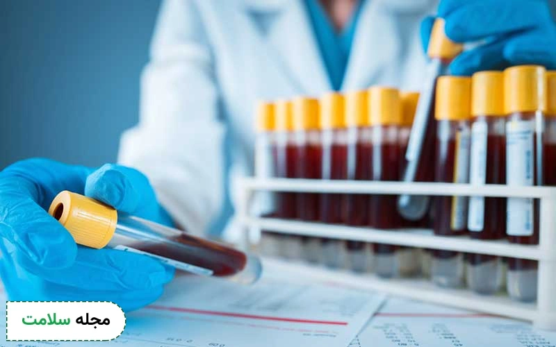 mcv در آزمایش خون چیست؟ علت بالا و پایین بودن m.c.v در آزمایش خون