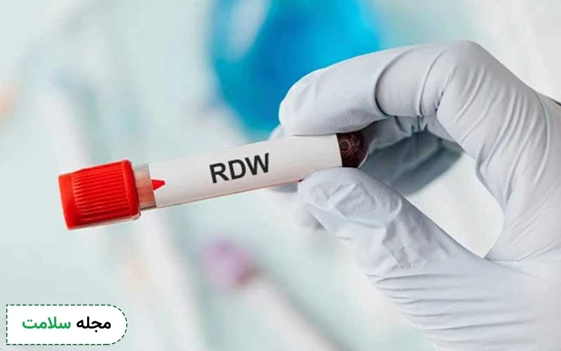 rdw در آزمایش خون نشانه چیست؟ بالا و پایین بودن rdw به چه معنا است؟ 9