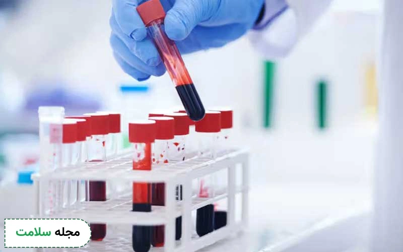ferritin در آزمایش خون نشانه چیست؟