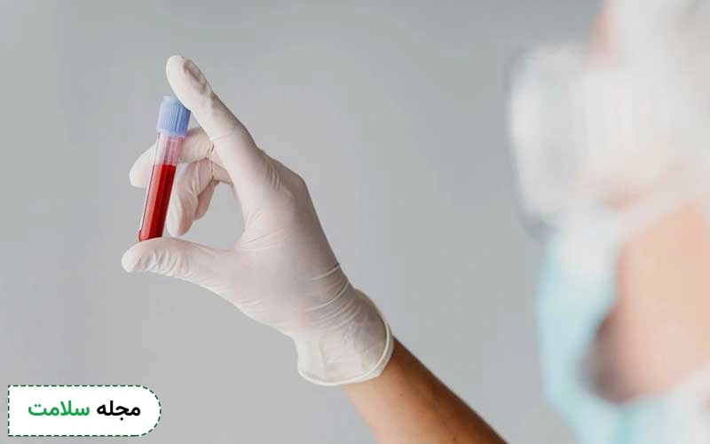 آزمایش Pct چگونه انجام می شود؟