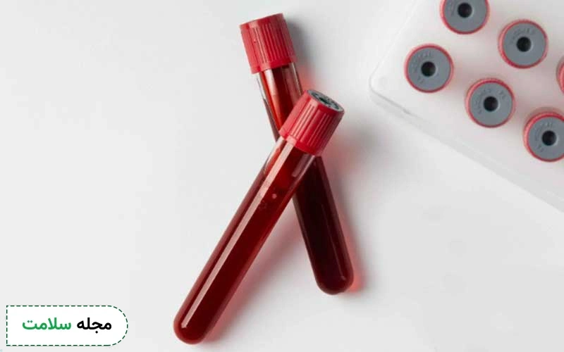 Ferritin برای سنجش پروتئین حاوی آهن
