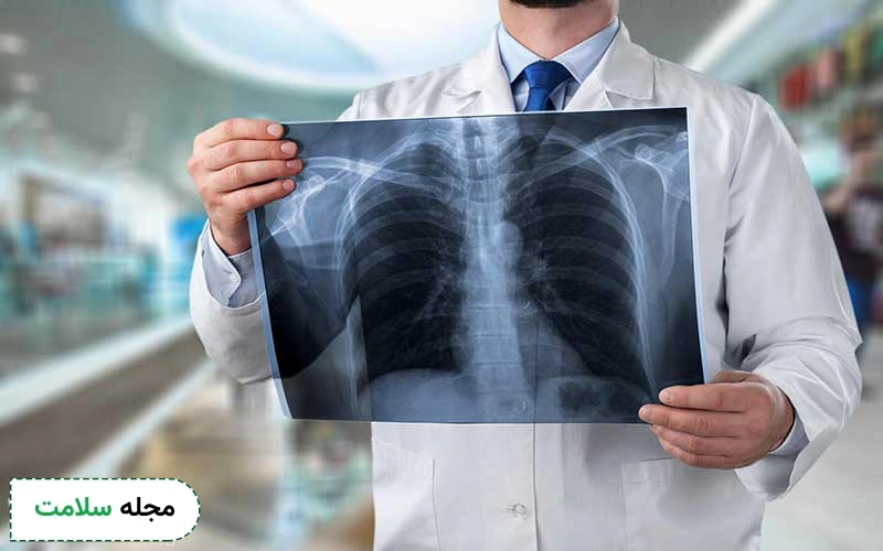 بعضی آمادگی ها پیش از انجام ام آر آی قفسه سینه لازم است.