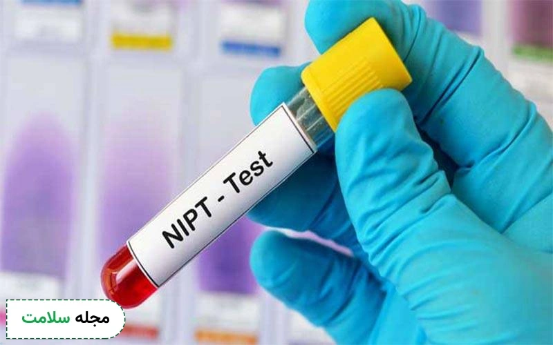 نمونه خون برای آزمایش NIPT