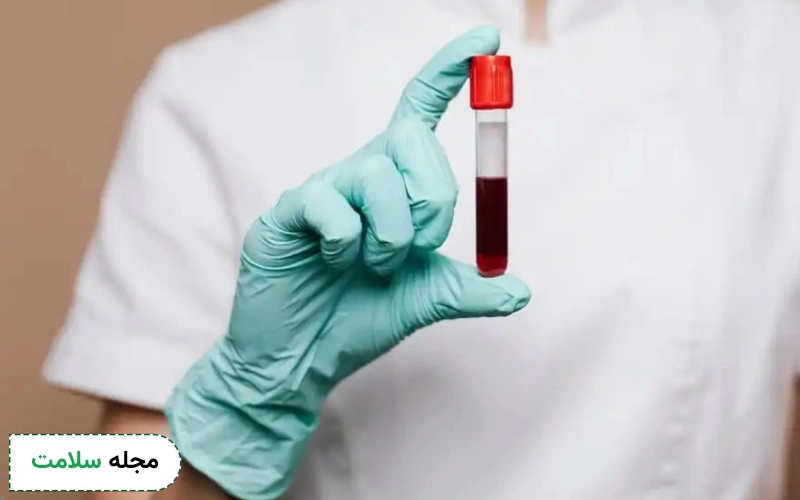 آزمایش بررسی علت لاغری چیست و چه مواردی را شامل می شود؟