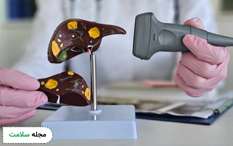روش نمونه برداری از کبد