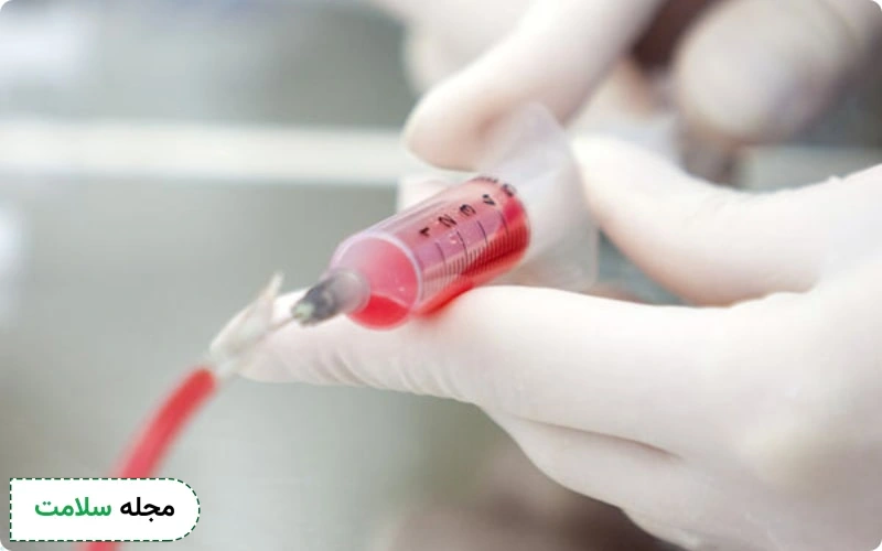چرا آزمایش کوردوسنتز تجویز میشود؟ چه نکاتی را باید قبل و بعد آن رعایت کرد؟