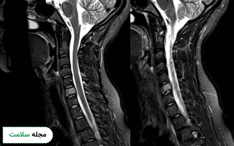 ام آر ای نیاز به مراقبت خاصی ندارد.