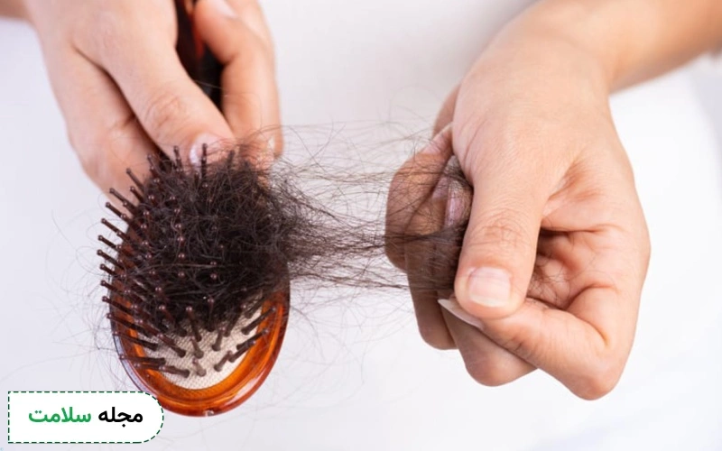 آزمایش هورمونی برای ریزش مو چیست؟