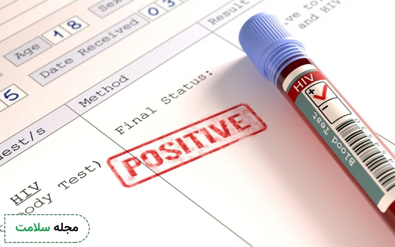 عکس جواب ازمایش ایدز مثبت